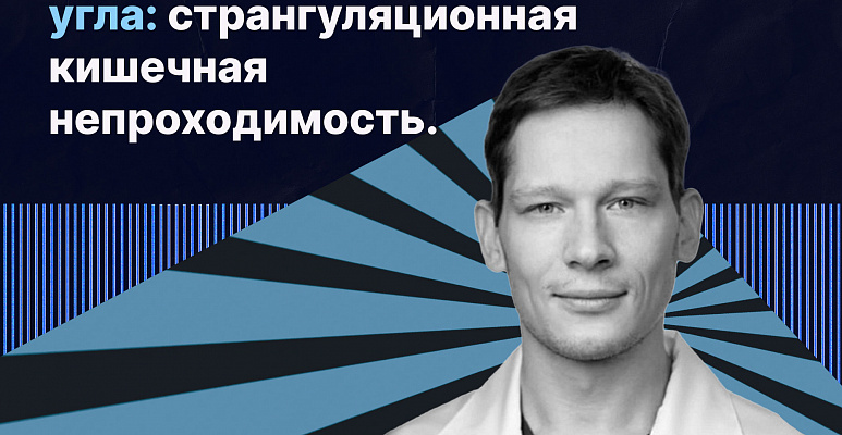 Клинический случай. Заворот илеоцекального угла: странгуляционная кишечная необходимость